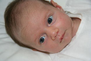 孕妇妊娠合并新生儿胱硫醚尿症怎么维生素B6？